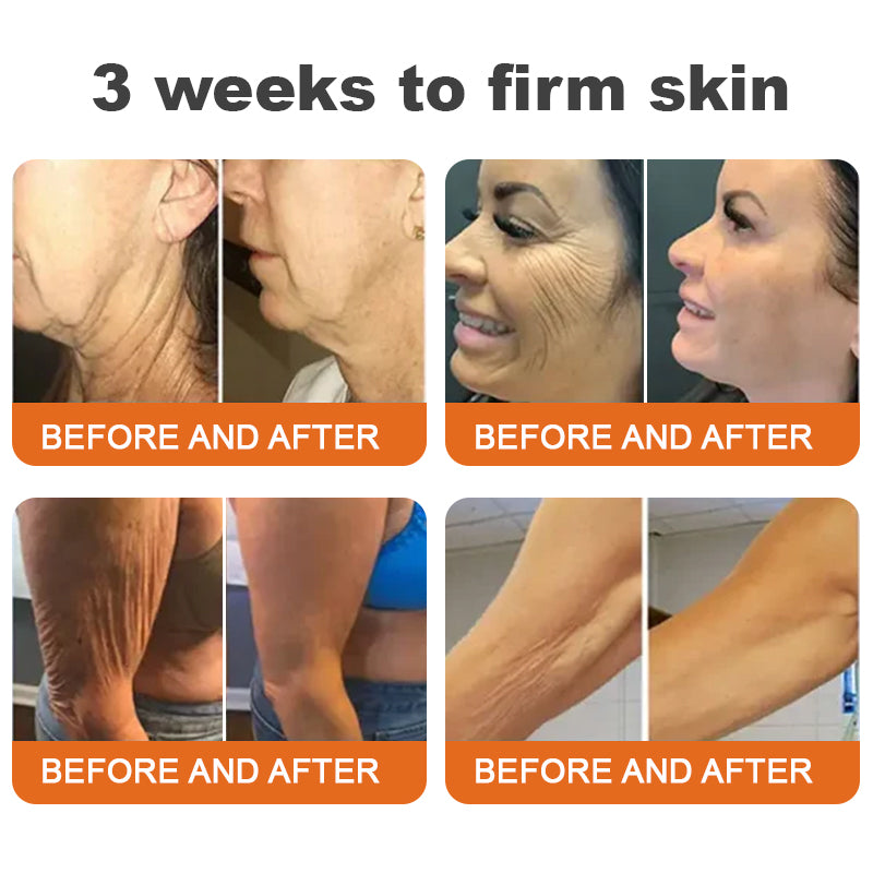 💫Made and Shipped from USA Rolimey® Botox Bee Venom Firming Serum Stick(⏳LAST DAY 70% OFF)✨